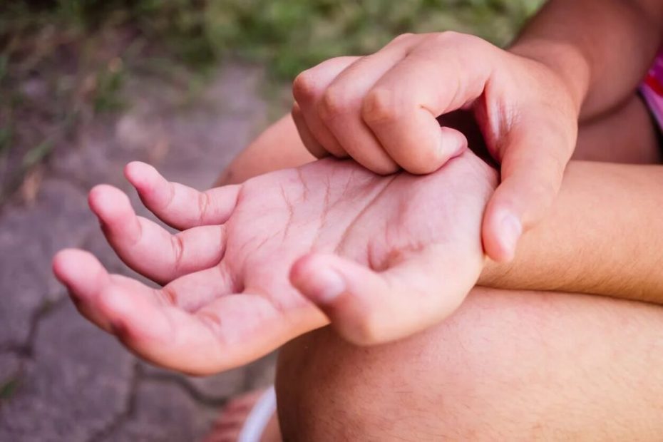 Significado de la Picazón en la Palma de la Mano Izquierda